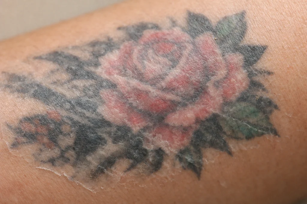 Stage Three: The Cloudy Skin Phase