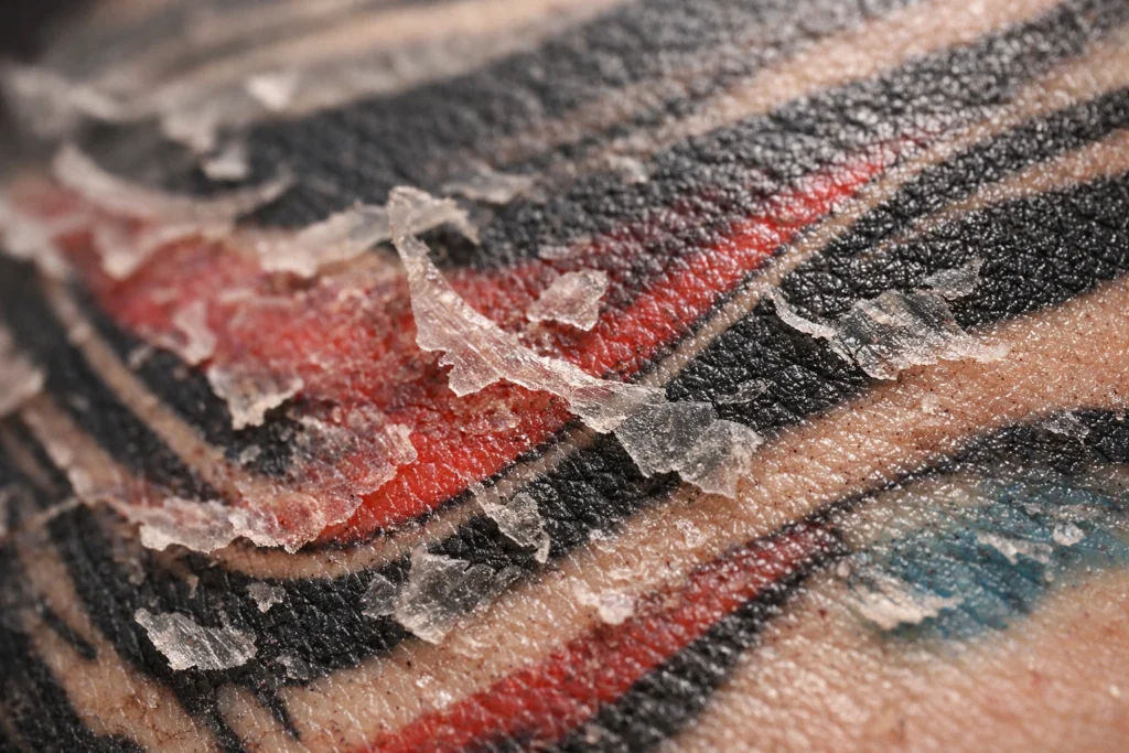 Stage Two: The Itching and Peeling Phase